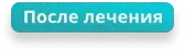 После